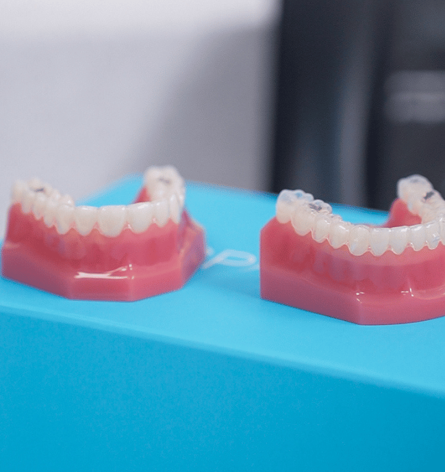 Treatments - Thornley Park Dental